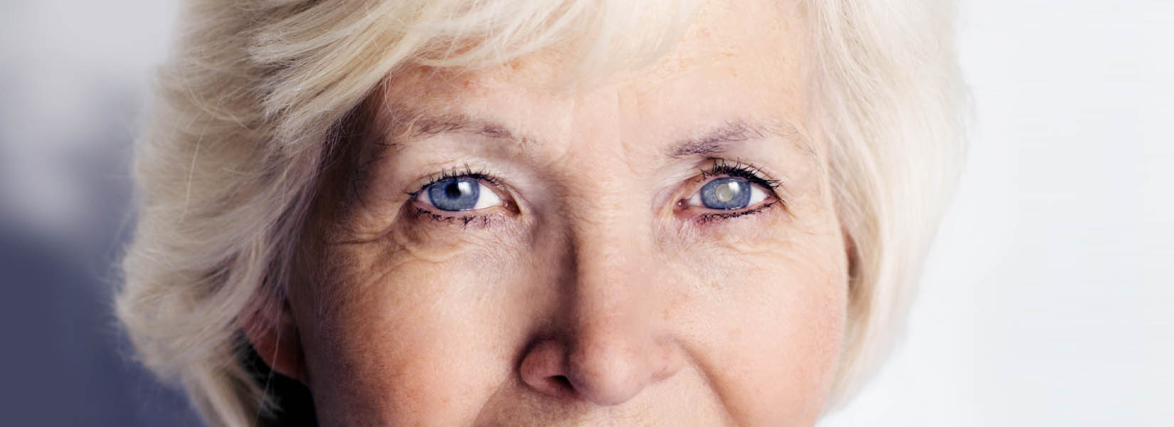 Cataract Surgery in Lebanon